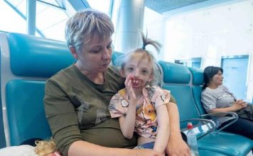 Jelena rodila dete bez pola lica, onesvestila se od šoka kad je videla: Svi su iznenađeni kako sad ova devojčica izgleda