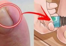 NAJBOLJI SAVJET ZA URASTAO NOKAT: Promjenu ćete osjetiti za nekoliko minuta, a djeluje i protiv modrica i gljivica!