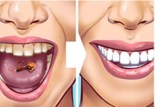 OVAJ ZAČIN UNIŠTAVA KAMENAC NA ZUBIMA: Samo ga nanesite na zatamnjeno mjesto – ZUBI ĆE PONOVO BITI BIJELI KAO SNIJEG