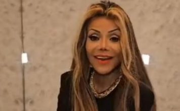 “Izgleda kao mumija, strah me da je gledam”: Jeziv izgled sestre Majkla Džeksona šokirao “Nije normalno neko živi ovako”