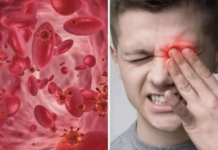 OVO SU SIMPTOMI NISKOG ŽELJEZA U KRVI: Tijelo vas upozorava JEDNIM SIMPTOMOM – ODMAH REAGUJTE