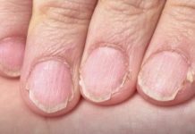 MUČE VAS UMOR, TANKA KOSA I LOMLJIVI NOKTI, EVO ŠTA VAM NEDOSTAJE U ISHRANI