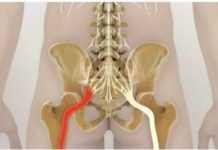 Trebate znati samo ove 2 vježbe i više vas neće boljeti išijas: Ovako su mi DIVNO pomogle!