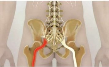 Trebate znati samo ove 2 vježbe i više vas neće boljeti išijas: Ovako su mi DIVNO pomogle!