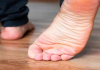 Simptom dijabetesa koji lako možete primijetiti na svojim stopalima: NIKAD GA NE IGNORIŠITE!