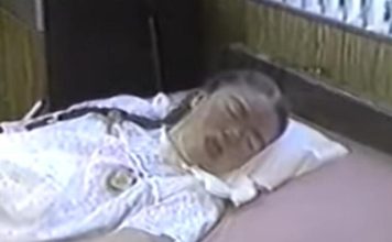 Sa 16 je obolela od gripa i pala u komu iz koje se nije budila 42 godine: Kad je otvorila oči, majka zanemela od prizora