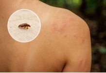 OVO SU ZNAKOVI DA U KUĆI IMATE STJENICE – EVO KAKO DA IH SE RIJEŠITE