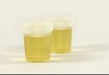 Vidite li mjehuriće u urinu? To može ukazivati na ozbiljnije zdravstveno stanje!