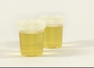 Vidite li mjehuriće u urinu? To može ukazivati na ozbiljnije zdravstveno stanje!