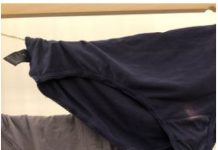 Znate li zbog čega vam se pojavljuju žute mrlje na donjem vešu?Ovo morate da znate!!!!!!