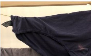 Znate li zbog čega vam se pojavljuju žute mrlje na donjem vešu?Ovo morate da znate!!!!!!