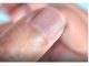 Doktorica otkrila i možda ćete se iznenaditi: IMATE LI OVAKVE IZBOČINE NA NOKTIMA – evo šta one znače!