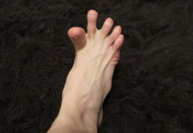 DA LI VAM SE GRČE PRSTI NA STOPALIMA? Evo na šta vas to upozorava, može biti znak većih problema