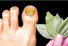 0va domaća KUPKA trenutno ubija gljivice na noktima: Pomoći će čak i unajgorim slučajevima!