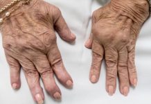 Jedan od glavnih uzroka reume nalazi se u ovoj namirnici: Sadrži opasnu bakteriju koja ubrzava ovu bolest