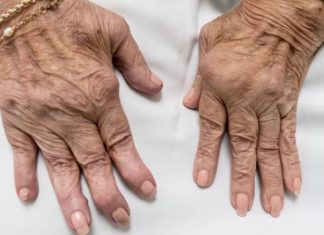 Jedan od glavnih uzroka reume nalazi se u ovoj namirnici: Sadrži opasnu bakteriju koja ubrzava ovu bolest