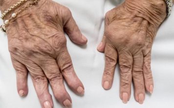 Jedan od glavnih uzroka reume nalazi se u ovoj namirnici: Sadrži opasnu bakteriju koja ubrzava ovu bolest