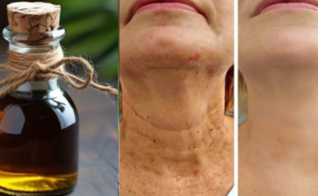 Čarobno ulje protiv starenja, Zaglađuje sve bore na licu snažnije od botoksa