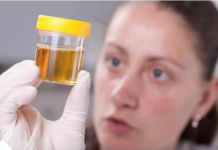 ČESTO MOKRITE MANJE KOLIČINE URINA? NOĆU SE BUDITE DA IDETE U WC? Ovo su simptomi jednog SINDROMA! Evo šta je u pitanju