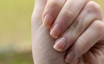 I nokti na nogama mogu da otkriju bolest: Ako PRIMIJETITE ove promene, moguće je da vas je napao „tihi ubica“