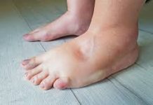 Recite zbogom otečenim nogama! – Evo kako vam 1šolja ovog čaja može pomoći! (FOTO)