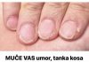 MUČE VAS UMOR, TANKA KOSA I LOMLJIVI NOKTI, EVO ŠTAVAM NEDOSTAJE U ISHRANI