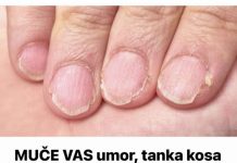 MUČE VAS UMOR, TANKA KOSA I LOMLJIVI NOKTI, EVO ŠTAVAM NEDOSTAJE U ISHRANI