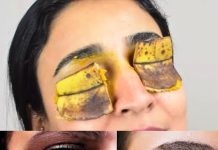Imate tamne mrlje ispod očiju ili podočnjake? Evo kako vam obična banana može pomoći u tome