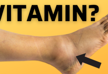 Savjeti  Bitni vitamini protiv oticanja nogu,zglobova i članaka