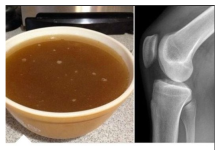 PITAT ĆE STAROST GDJE JE BILA PAMET: JEDAN SASTOJAK ZAUSTAVI PROPADANJE ZGLOBOVA I HRSKAVICE