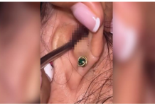 SVRBELO JE UVO DO BESVESTI, OTIŠLA U BOLNICU, A TAMO ŠOK: Kada su videli šta je unutra nisu mogli da veruju svojim očima! (FOTO)