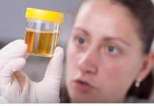 Često Mokrite Manje Količine Urina? Noću Se Budite Da Idete U Wc?