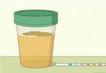 Koliko Puta Dnevno Mokrite? Evo Koliko je Normalno