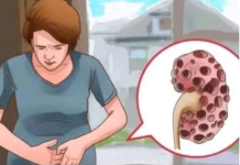 Kada se pojave problemi s bubrezima, vaš organizam šalje sljedeće signale: 6 simptoma koje ne biste trebali ignorirati!