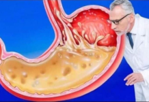 OVO JEDITE ZA VEČERU 3 DANA ZAREDOM: Nećete vjerovati šta će izaći iz vašeg stomaka