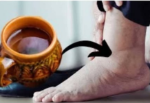 ČAJ koji me je svekrva naučila da pravim odmah otklanja otoke nogu, gležnjeva i stopala: Djeluje!