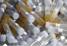 ZAŠTO IMATE JAK I NEPRIJATAN MIRIS URINA: Ovaj znak organizma ne smijete zanemariti! EVO NA ŠTA VAS UPOZORAVA