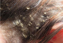 KOSA VAM JE MASNA I PUNA PERUTI: Uzmite ovu namirnicu i utrljajte u tjeme, ZA 5 SEKUNDI IZGLEDA KAO TEK OPRANA