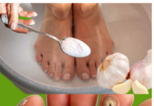 Kurje oko nestaje bez traga: bijeli luk i ova smjesa čine čudo!