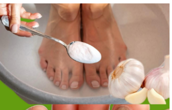 Kurje oko nestaje bez traga: bijeli luk i ova smjesa čine čudo!