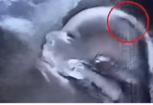 „Beba rođena s gustom kosom oduševila bolnicu – i celu zajednicu“