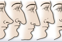 ZVUČI ČUDNO, ALI JE ISTINITO: Evo šta OBLIK NOSA govori O VAMA! Svima je pogodilo