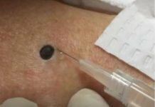 “Zeni je ovo stojalo na ledjima godinama- Kada je doktorica uzela spricu i bocnula svi su zaledjeni ostali.” SNIMAK pregledan 33 miliona puta