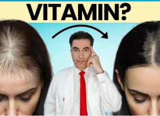 OPASNO: Deficit ovog vitamina UZROKUJE gubitak kose kod žena!