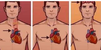 1 ZNAK NA KOŽI UKAZUJE DA JE VAŠE SRCE U LOŠEM STANJU: Ako ovo primijetite javite se doktoru ODMAH!