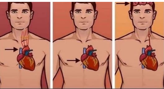 1 ZNAK NA KOŽI UKAZUJE DA JE VAŠE SRCE U LOŠEM STANJU: Ako ovo primijetite javite se doktoru ODMAH!