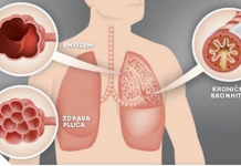 NAŠE BAKE SU NAJBOLJE ZNALE: Evo kako izliječiti astmu, bronhitis i plućne bolesti
