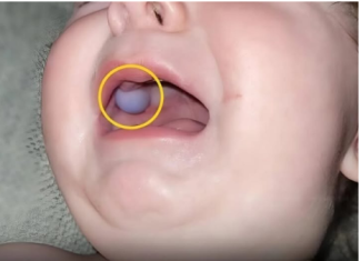 Majka je primetila nešto neobično u ustima svog devetomesečnog sina i odmah je otišla kod lekara — otkriće lekara bilo je iznenađujuće.