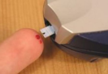 Najraniji znak da vam šećer razara organizam: Obratite pažnju na 1 opasan simptom