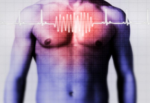 Pet ranih znakova srčanog udara koji se često javljaju zimi